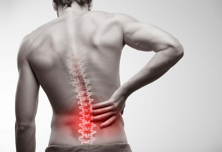 MSK Conditions - Lower Back Pain